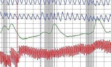 lie detector test chart